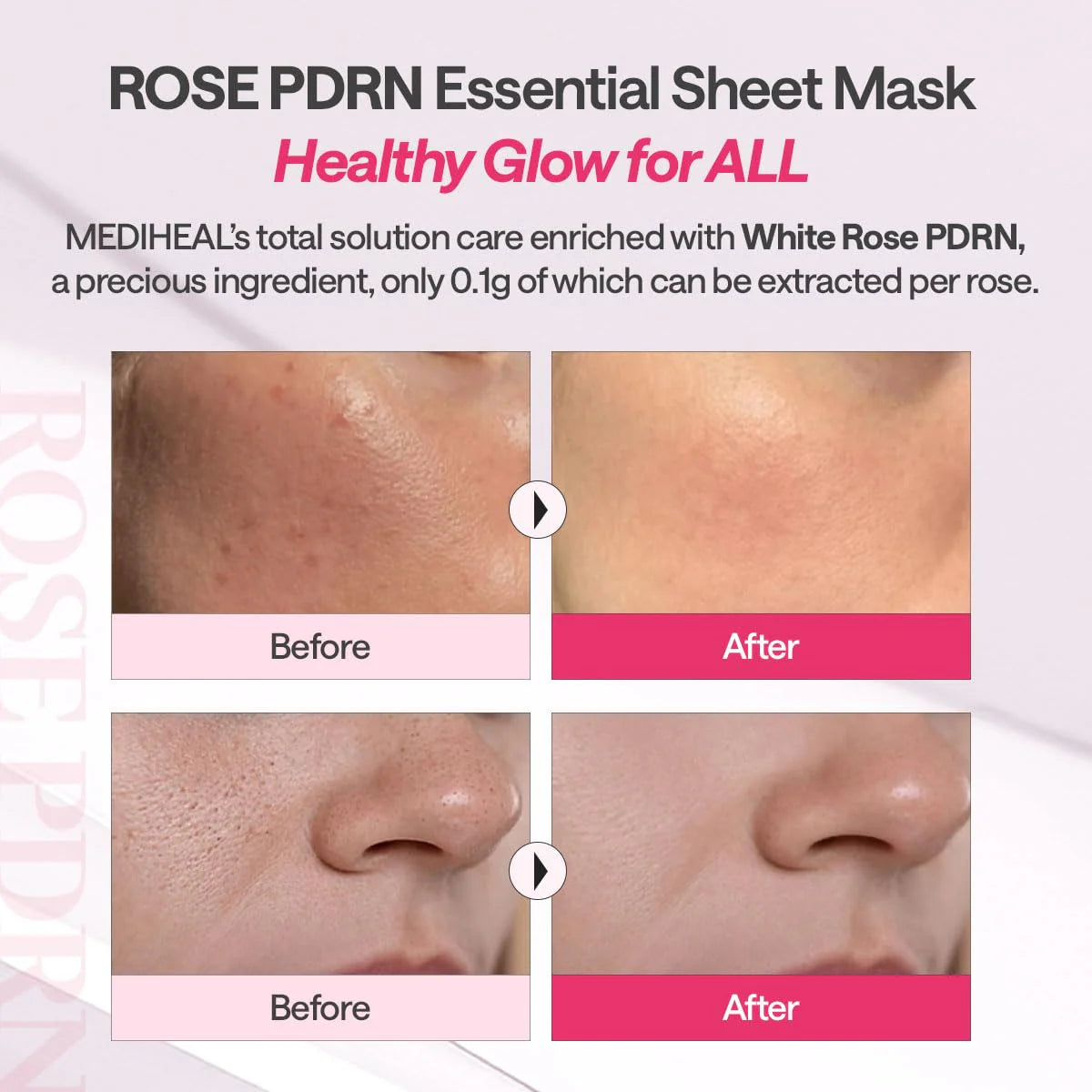 Mediheal Rose PDRN Essential Mask Sheet 24ml x 11ea