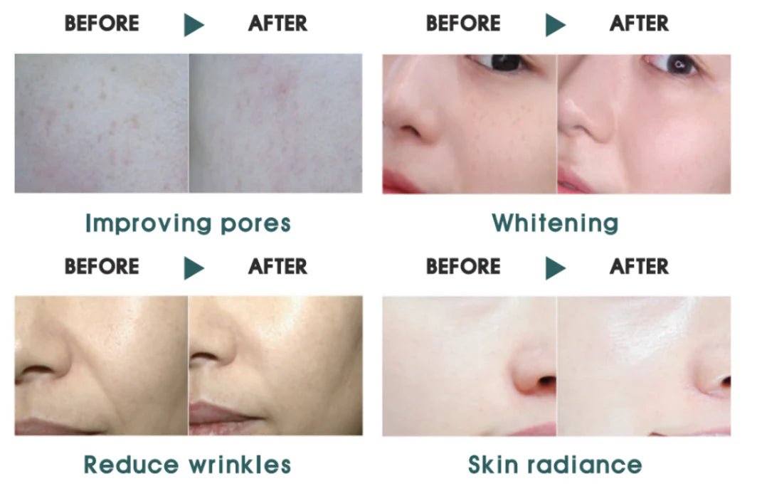 VT PDRN Essence 100 30ml - Lili Beauty